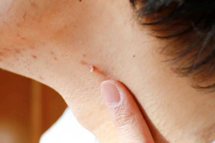 泡温泉手指感染HPV,专业的一站式物流信息网_123随叫随到