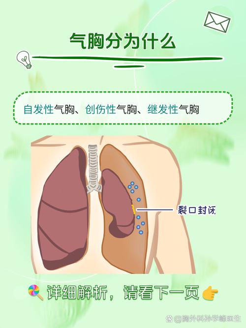 高瘦男性容易得气胸,仓配一体,时效速达