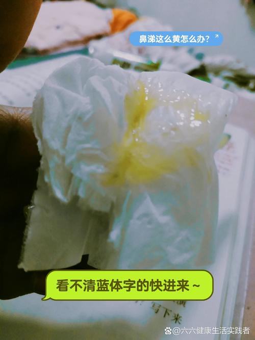 7种颜色的鼻涕预示,上门取货_123随叫随到