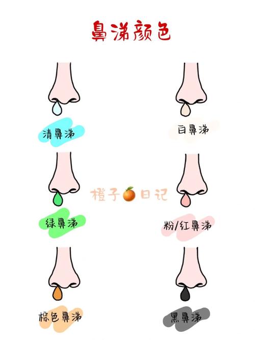 7种颜色的鼻涕预示,快递单号查询_123随叫随到