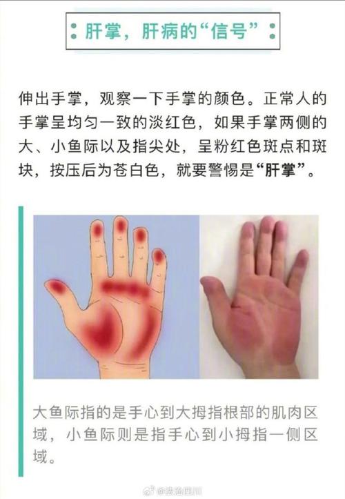 身上发痒竟确诊肝癌,物流专线直达_123随叫随到