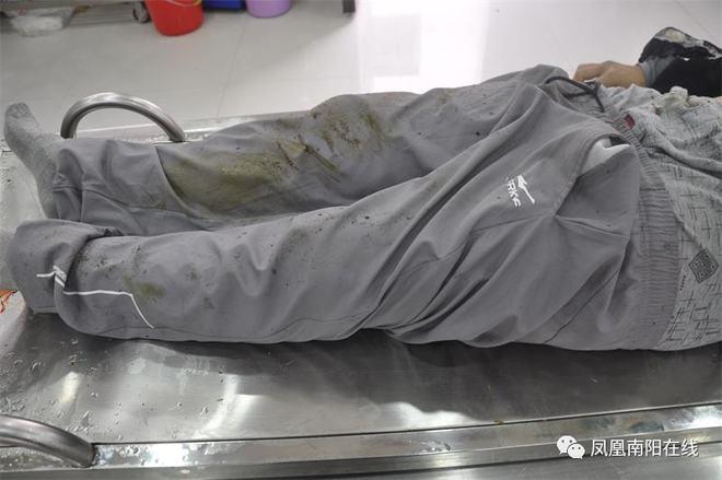 树林中发现无名男尸,上门取货_123随叫随到