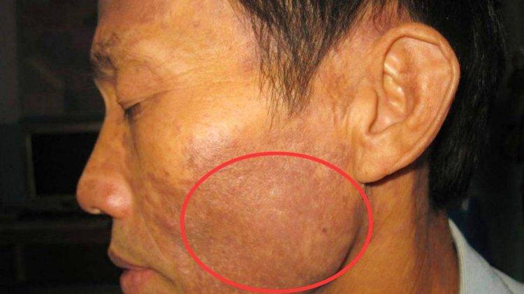 皮肤瘙痒一查是肝癌,让发货找车找物流更简单_123随叫随到