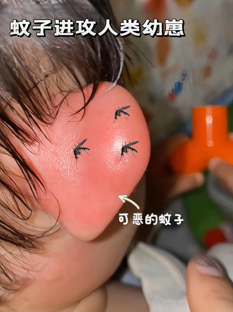 未拔蚊香液房间被烧,仓配一体,时效速达