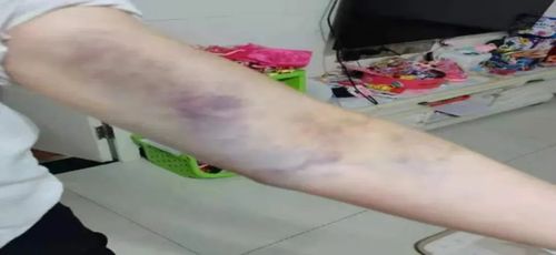 女子无奈起诉奶奶,物流专线直达_123随叫随到