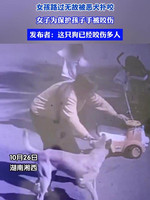 女童被狗扑咬受伤,让发货找车找物流更简单_123随叫随到