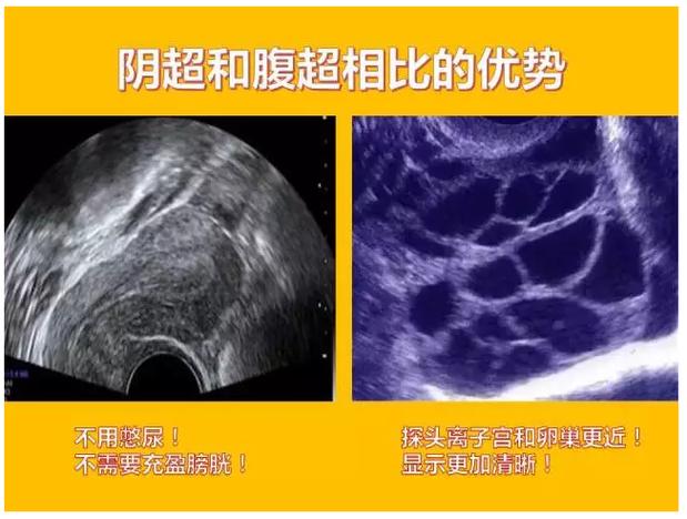 医生误做腹超被停工,上门取货_123随叫随到