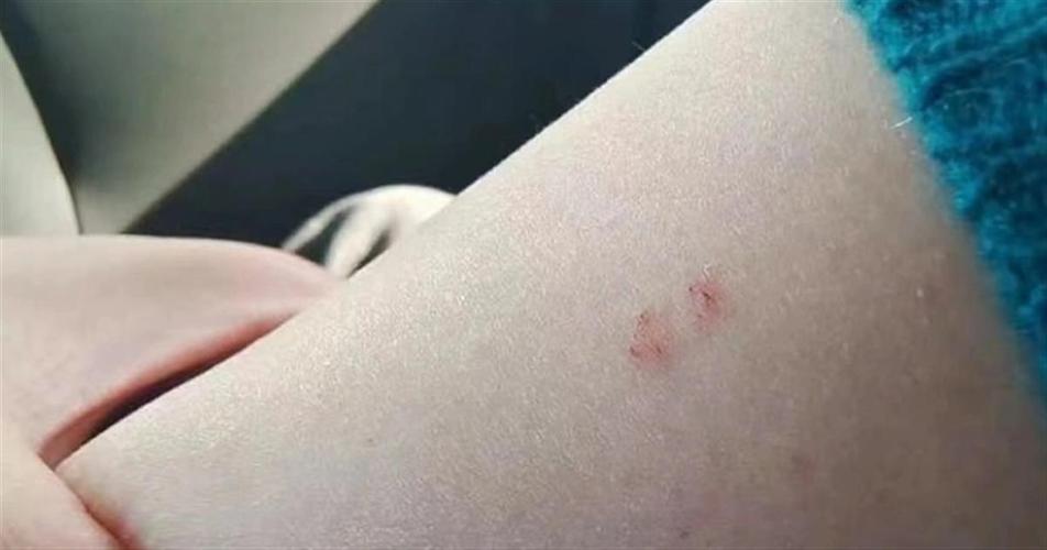 每年超25万人被蛇咬,上门取货_123随叫随到