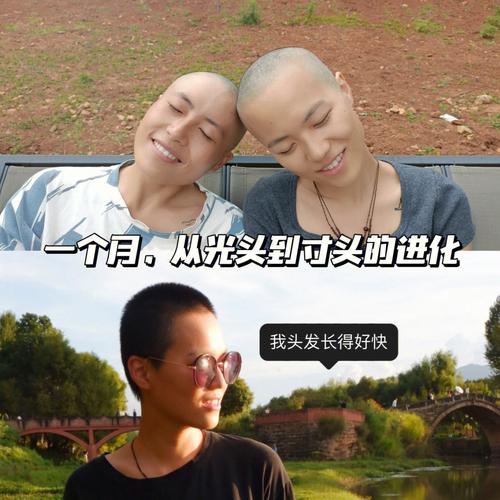 因发量太多剃掉头发,物流专线直达_123随叫随到