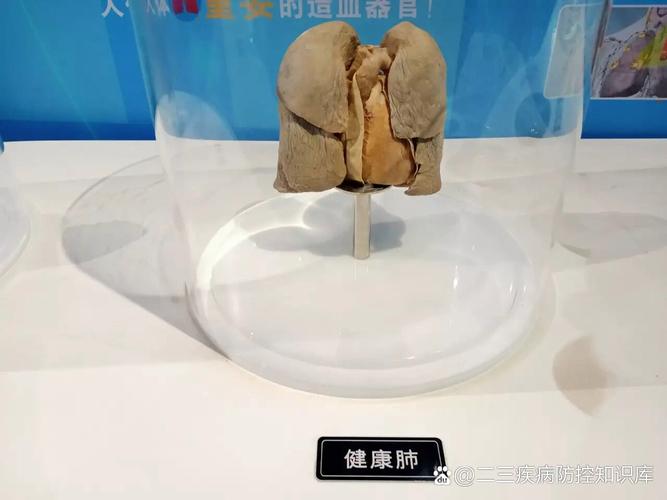 吸烟如何摧毁你的肺,让发货找车找物流更简单_123随叫随到